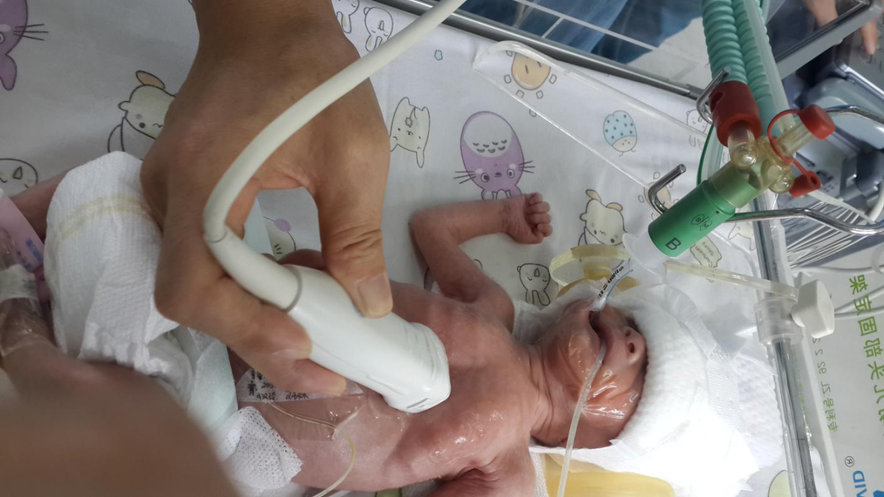 B超检查.png B超检查.png