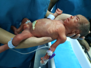 早产儿2_编辑.png 早产儿2_编辑.png