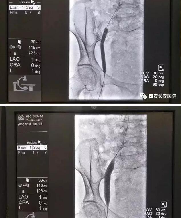 QQ截图20170814170819.jpg